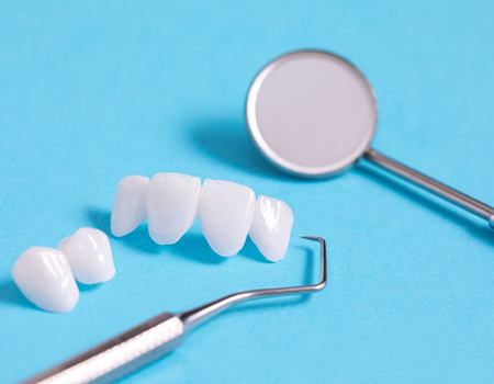 Two dental bridges on a blue surface next to dental tools