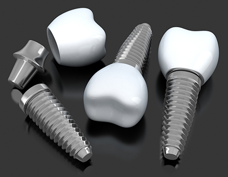 Animated implant supported dental crowns