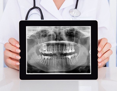 Digital dental x-rays on tablet computer