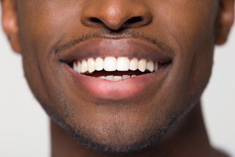Man showing strong teeth