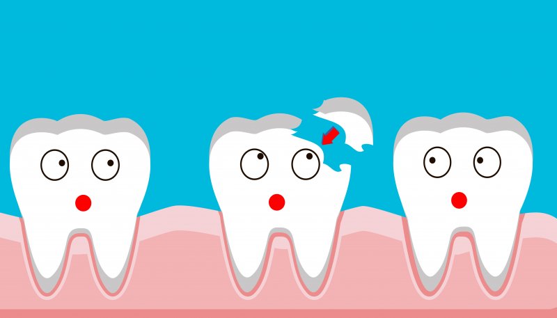 illustration of a chipped tooth in Spring House