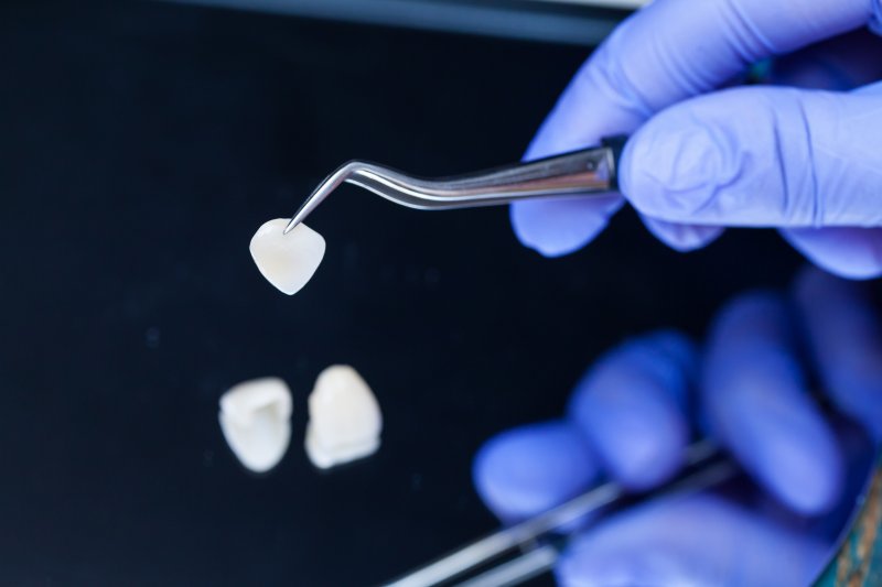 Dentist holding a veneer with tweezers