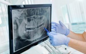 Dental x-ray. 
