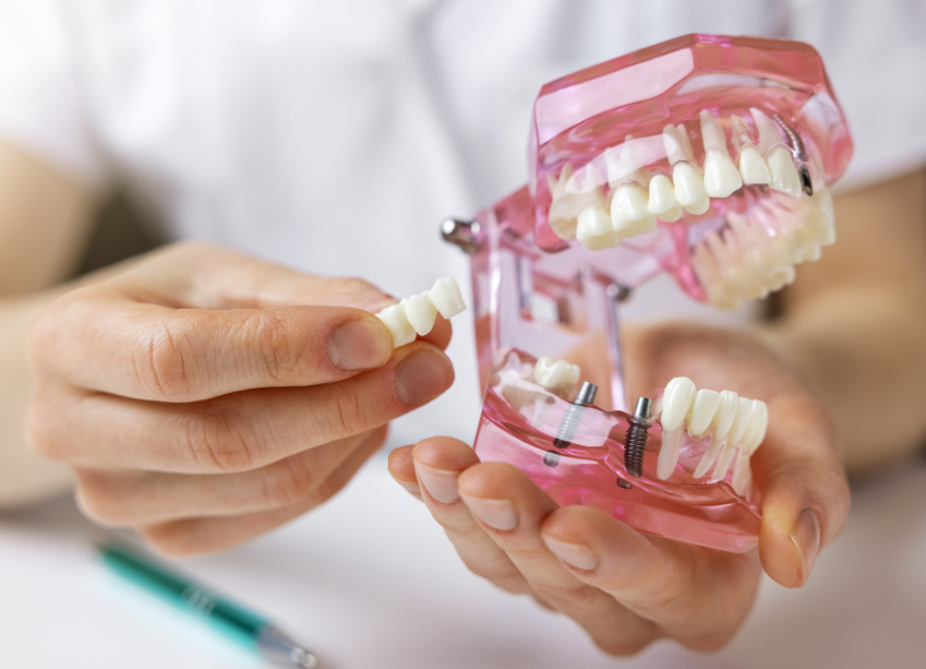 Dentist holding model dental bridge
